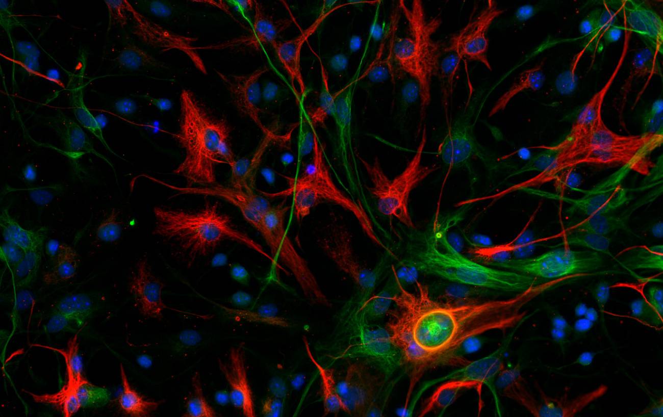 Glioblastoma mesenquimal de ratón. | CNIO