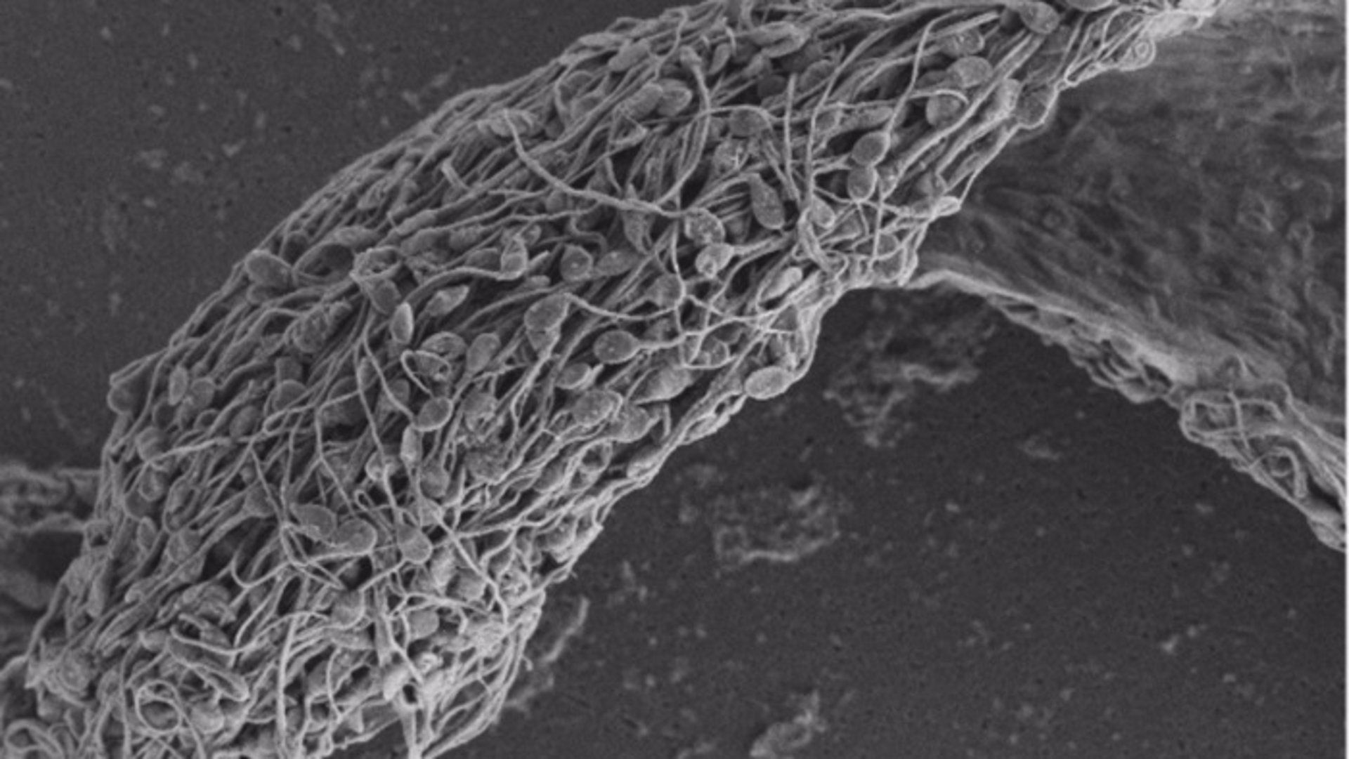 Micrografía electrónica de barrido de espermatozoides humanos pegados e inmovilizados por un anticuerpo antiespermático. Ep