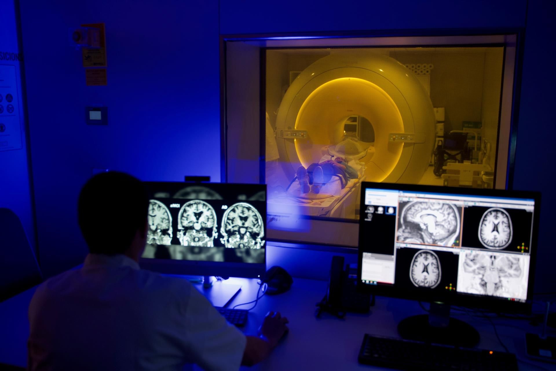 Medición del flujo sanguíneo del cerebro mediante resonancia magnética - FUNDACIÓN PASCUAL MARAGALL