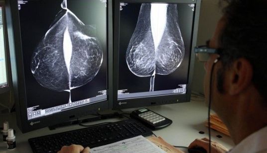 Estudio de una mamografía en el hospital Río Hortega de Valladolid. Foto Rubén Cacho ICAL