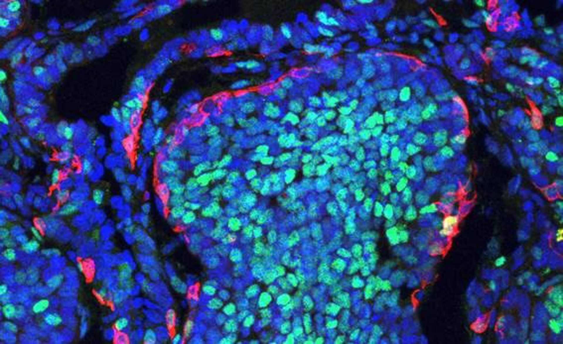  Imagen de un tumor de mama en ratón que muestra la segregación de ambas poblaciones celulares - IN-CSIC-UMH - Archivo